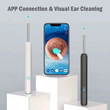 RONY Wireless Earwax Removal Tool Kit with Camera - 1080P Otoscope Next Gen Ear Wax Removal Set with Led Light - Ear Wax Removal Compatible for iPhone iPad Android Smart Phone, Black